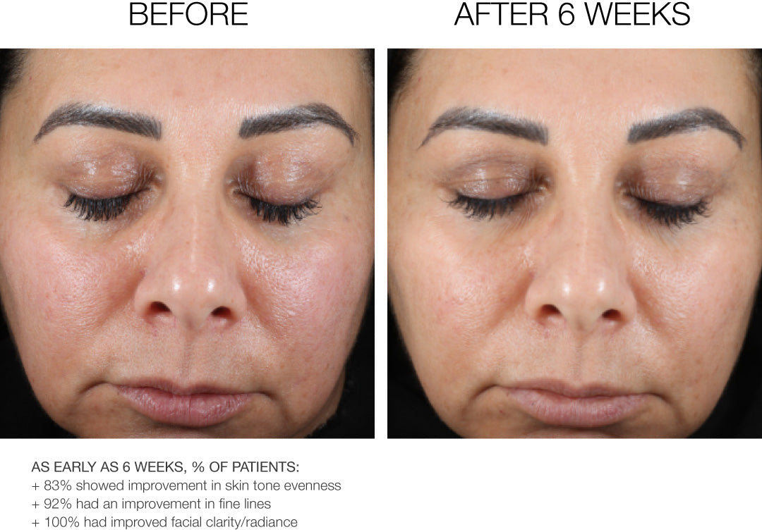 Shim Ching MD Advanced Wrinkle + Texture Cream 50ml
