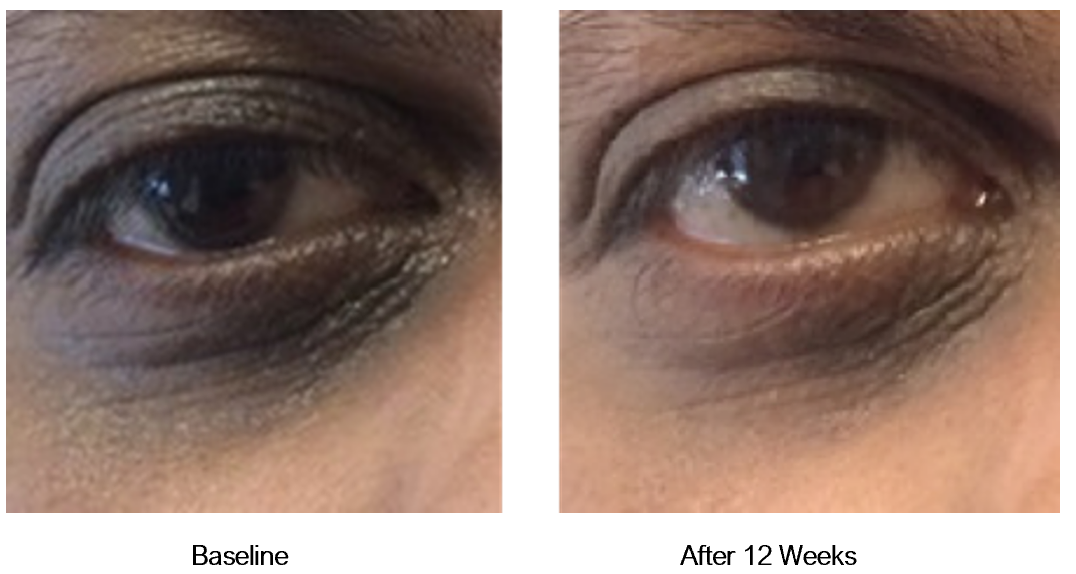 Shim Ching MD Retinol Eye Luminescence