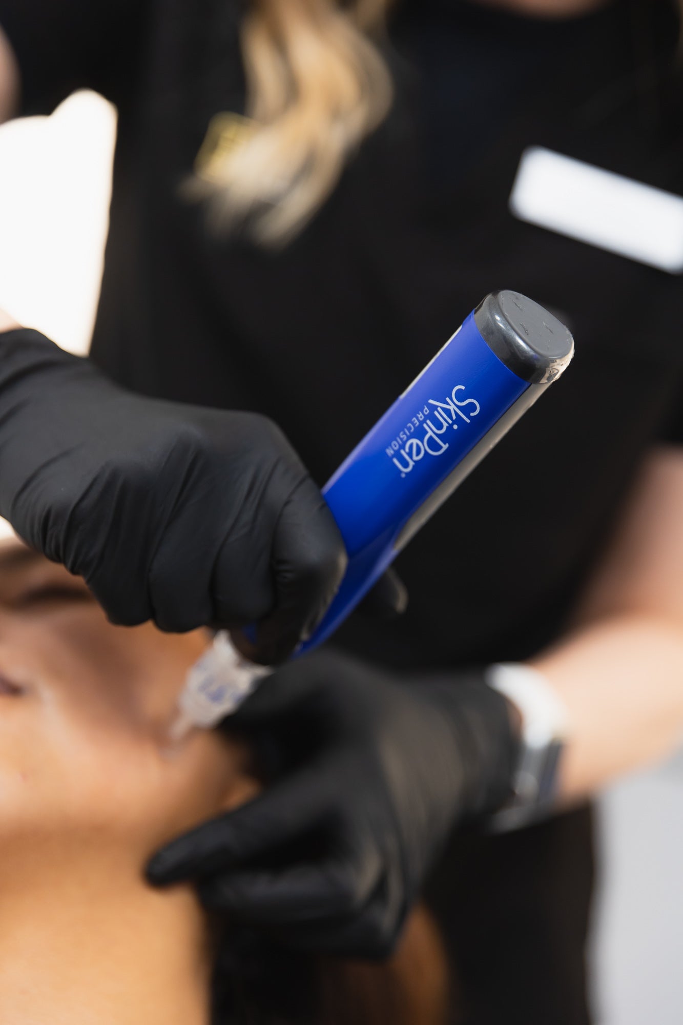 Microneedling FLASH SALE- $500 OFF A PACKAGE OF 3