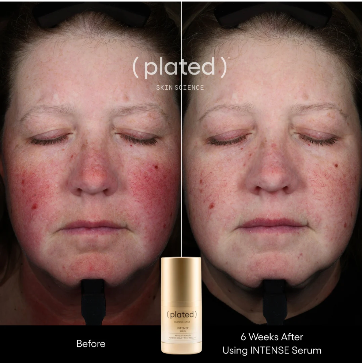 Plated INTENSE Serum