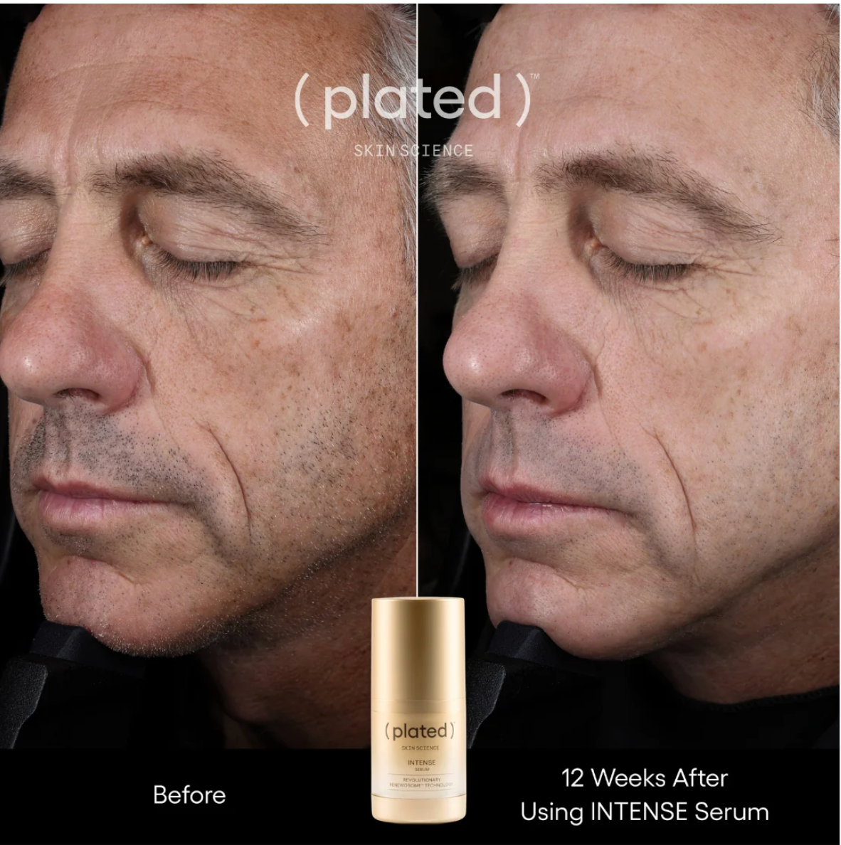 Plated INTENSE Serum