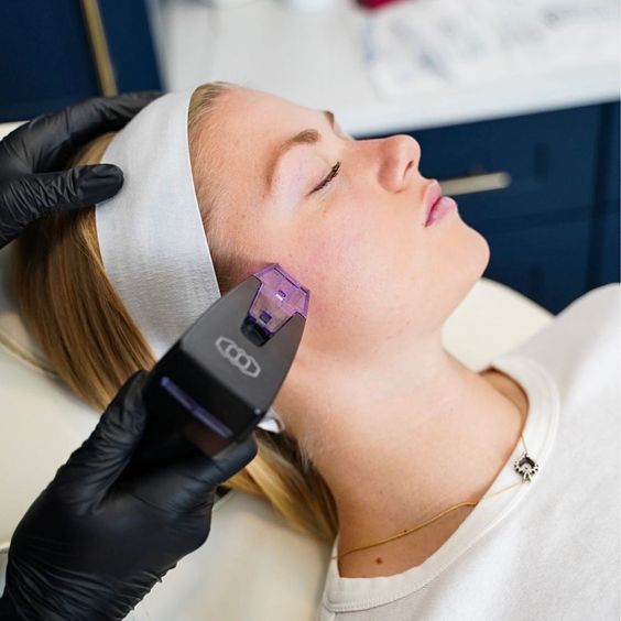 Morpheus8 | Asia Pacific Plastic Surgery