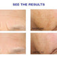 ZO Wrinkle + Texture Repair - Before and after